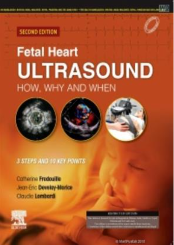 Fetal Heart Ultrasound